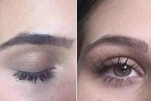 Entfernung von Permanent Make-up und Microblading in Frankfurt